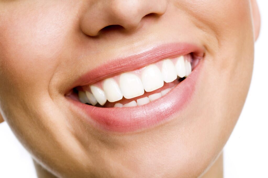 Say Cheese! The Art of Professional Teeth Whitening